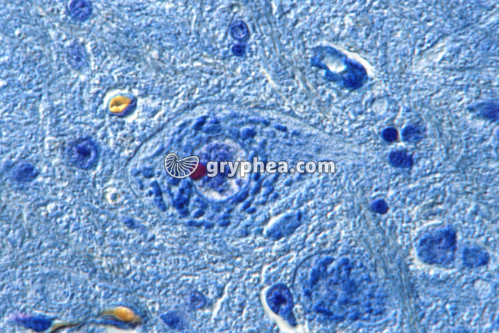 Neurone avec corps de Nissl x340 - gryphea.com